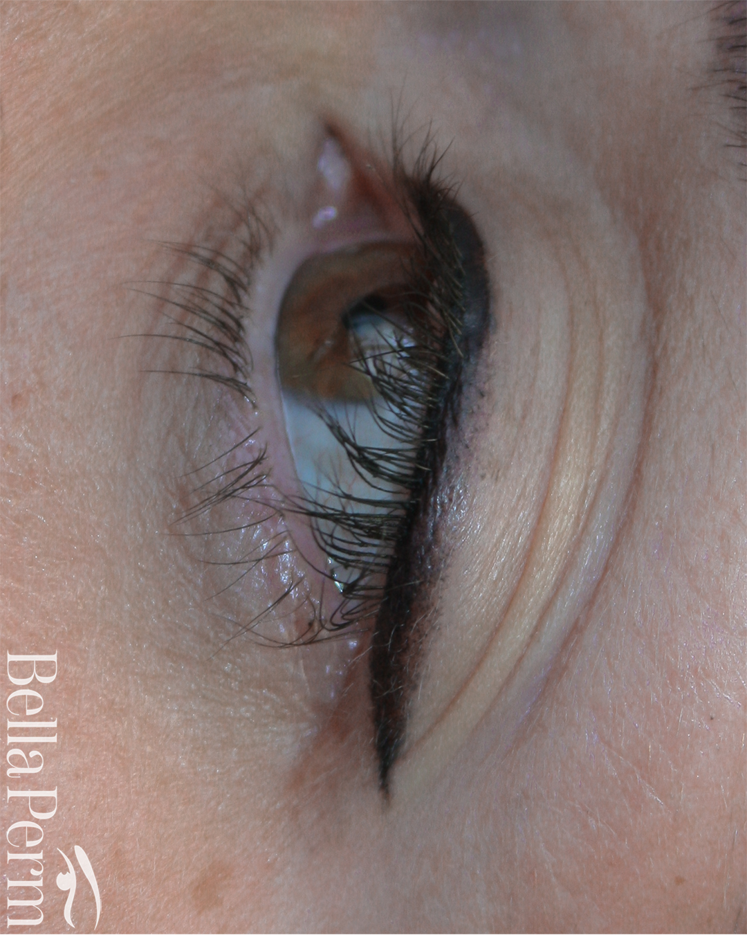 Eyeliner Removal 1