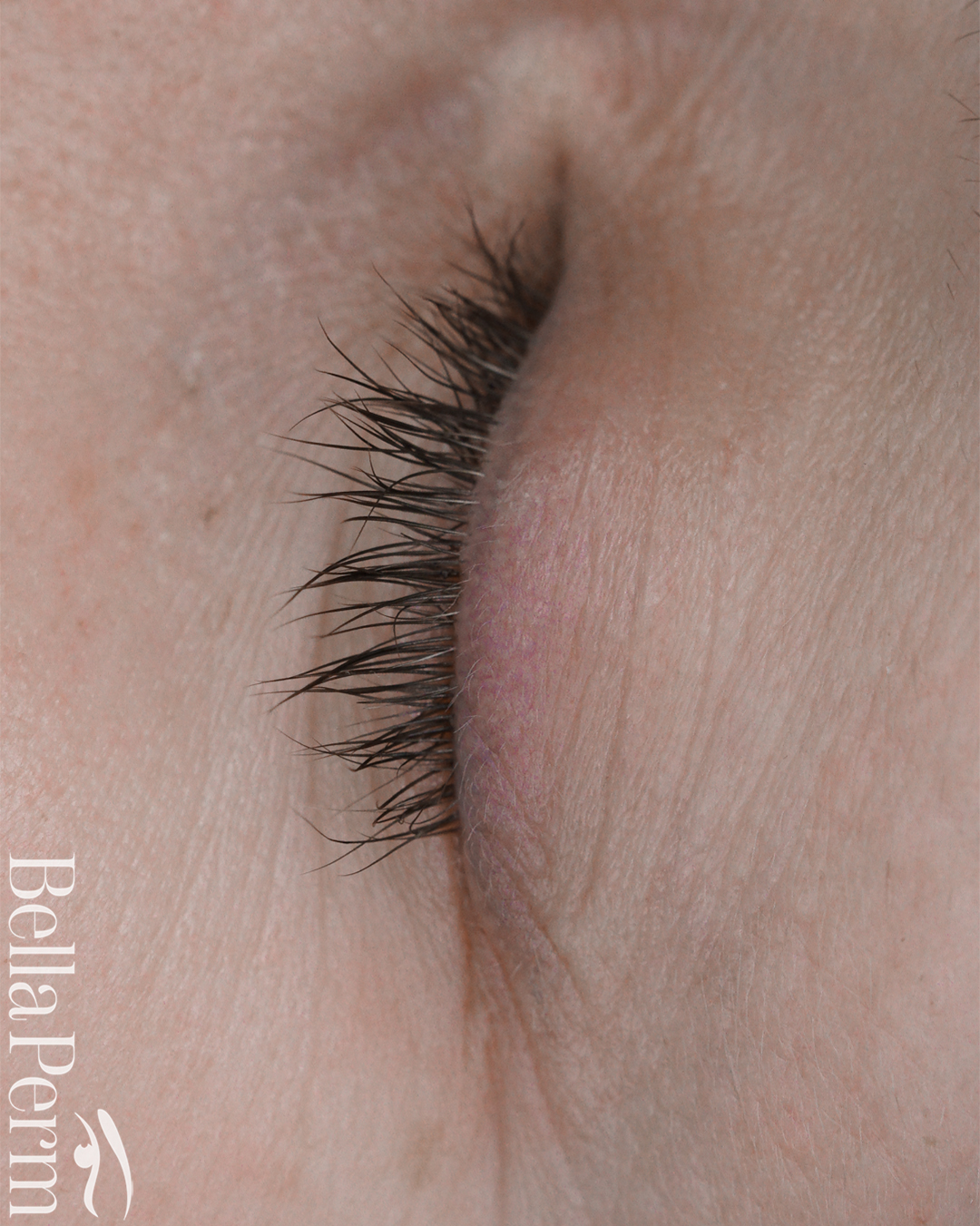 Eyeliner Removal 2