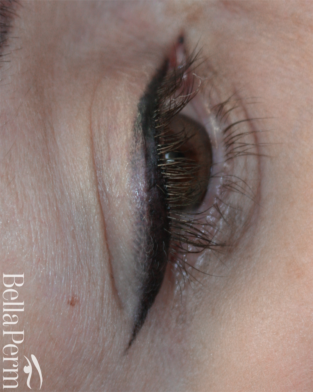 Eyeliner Removal 3
