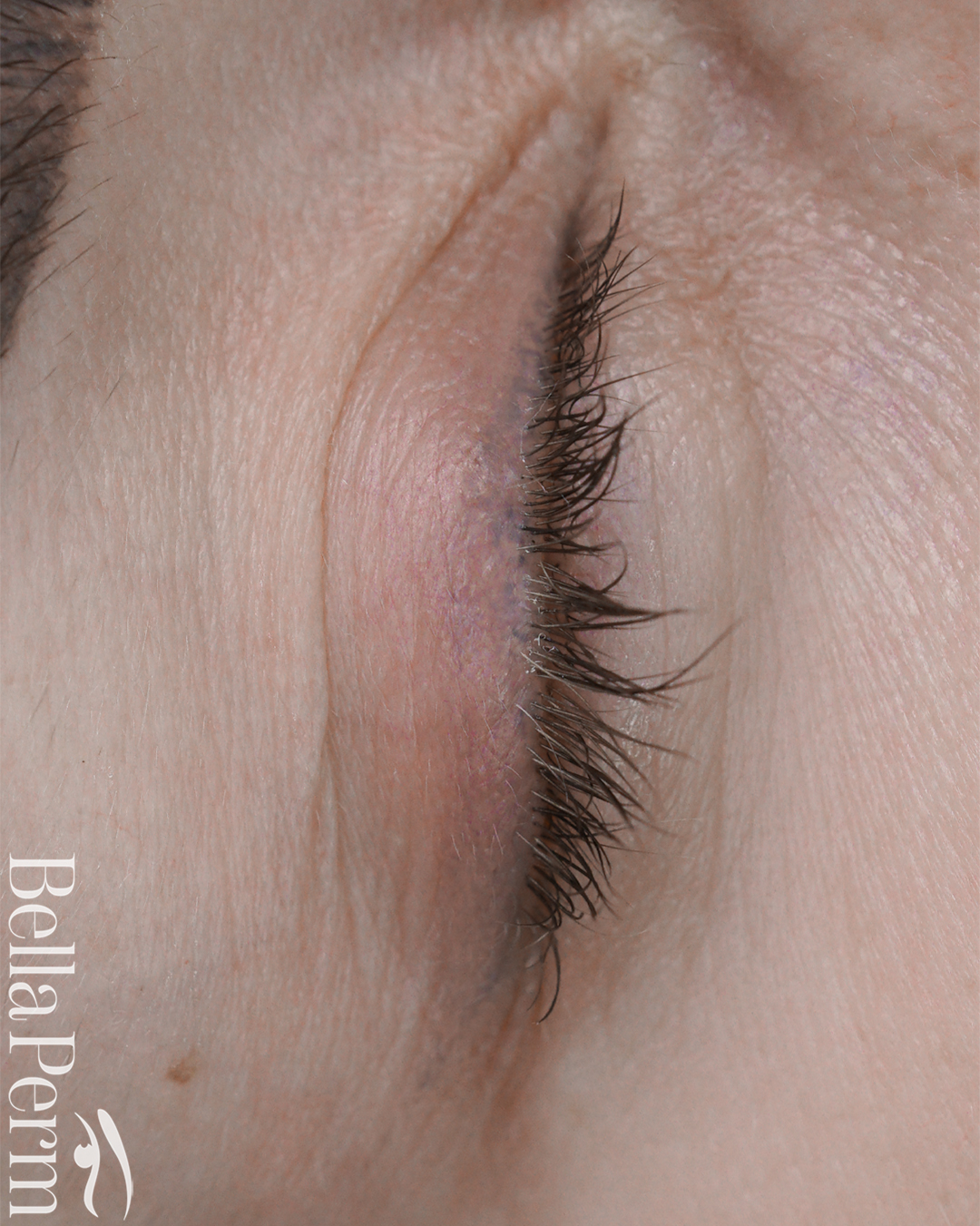 Eyeliner Removal 4